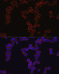 Western blot - TGF beta induced (TGFBI) Rabbit pAb (A2561)