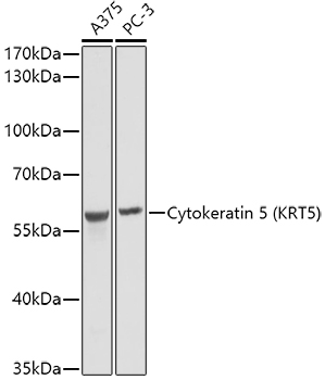 Cytokeratin 5 (KRT5) Rabbit pAb