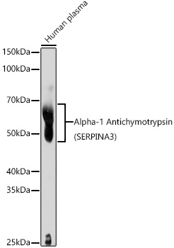 Alpha-1 Antichymotrypsin (SERPINA3) Rabbit pAb