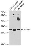 Western blot - CLDND1 Rabbit pAb (A2945)