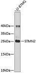 Western blot - STMN2 Rabbit pAb (A2997)