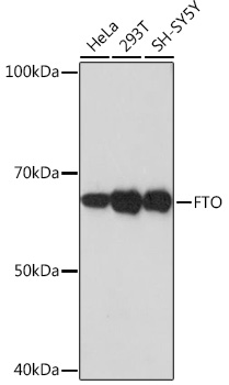 FTO Rabbit mAb