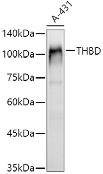 CD141/Thrombomodulin Rabbit pAb