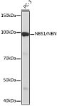 Western blot - NBS1/NBN Rabbit mAb (A4197)