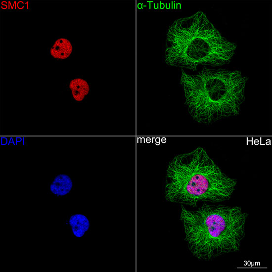 SMC1 Rabbit mAb