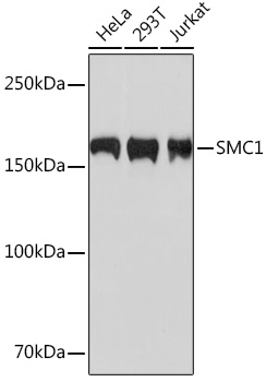 SMC1 Rabbit mAb