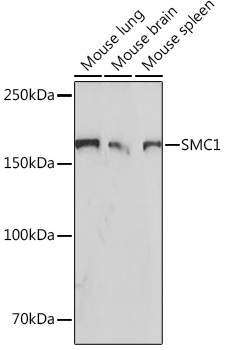 SMC1 Rabbit mAb