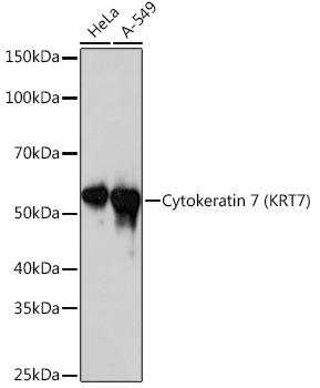 Cytokeratin 7 (KRT7) Rabbit mAb