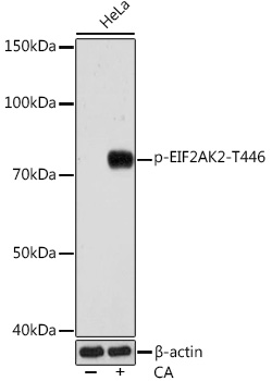 Phospho-PKR/EIF2AK2-T446 Rabbit mAb