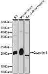 Western blot - Caveolin-3  Rabbit mAb (A4891)