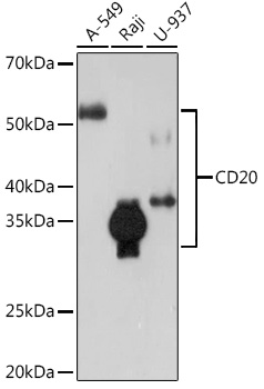 CD20 Rabbit mAb