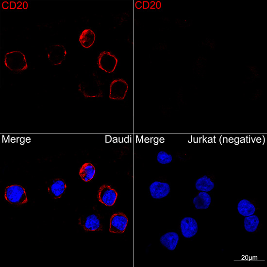 CD20 Rabbit mAb