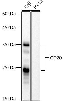 CD20 Rabbit mAb