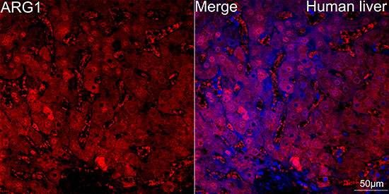 Arginase 1 (ARG1) Rabbit mAb