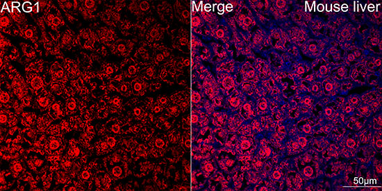 Arginase 1 (ARG1) Rabbit mAb