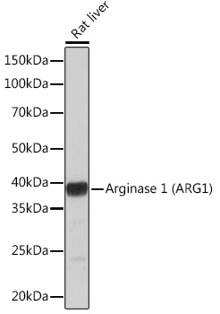 Arginase 1 (ARG1) Rabbit mAb