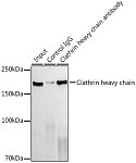 Western blot - Clathrin heavy chain Rabbit mAb (A4943)