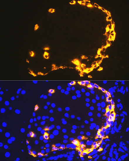 ABclonal:Immunofluorescence - GLP-1 Rabbit mAb (A4981)