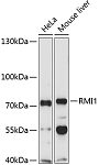 Western blot - RMI1 Rabbit pAb (A4991)