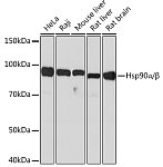 Western blot - Hsp90α/β Rabbit mAb (A5027)