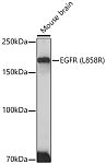 Western blot - EGFR (L858R) Rabbit mAb (A5031)
