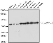 Western blot - ATGL/PNPLA2 Rabbit mAb (A5126)