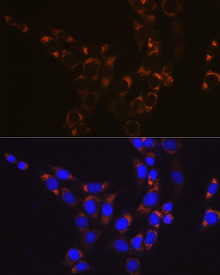 GLUD1 Rabbit mAb