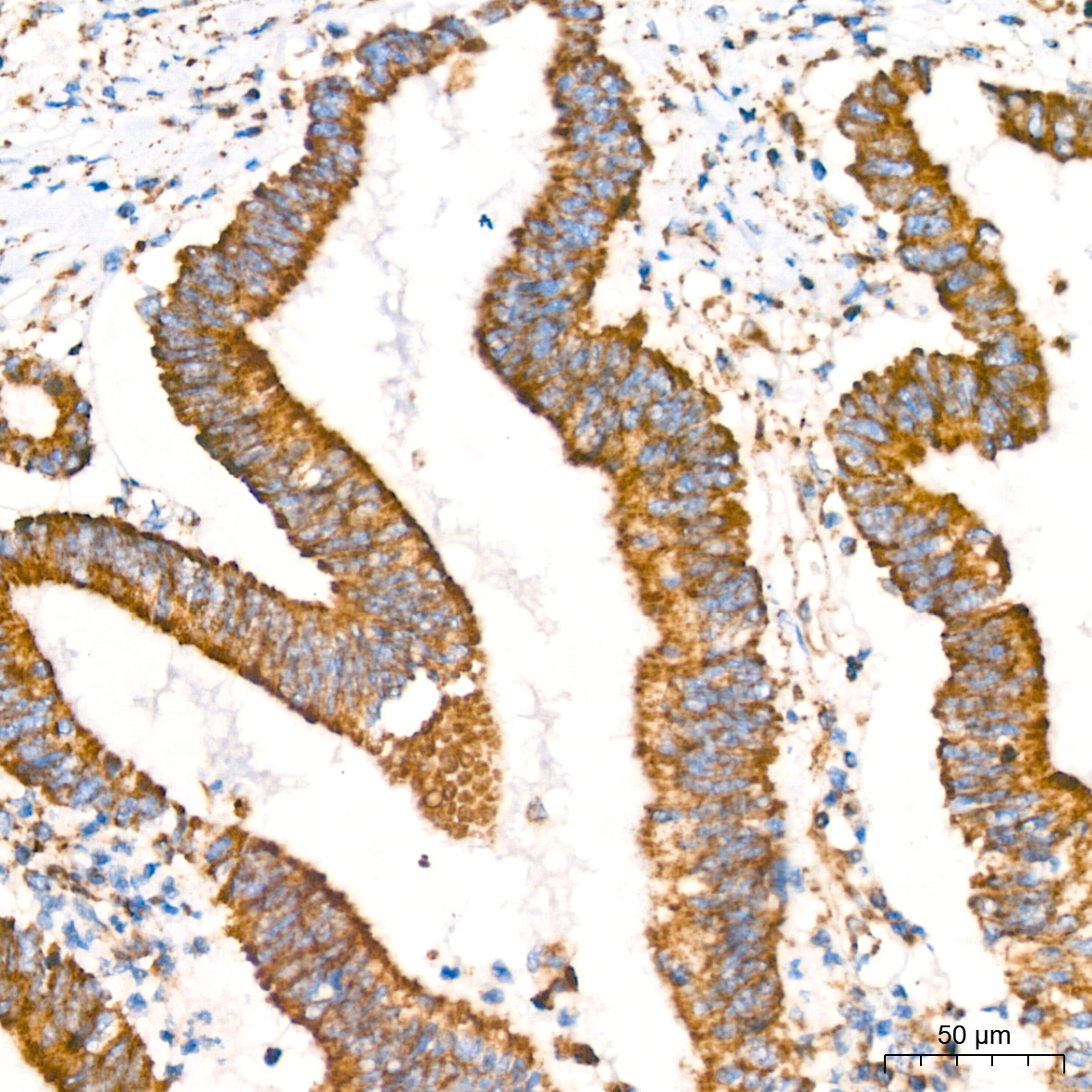 GLUD1 Rabbit mAb