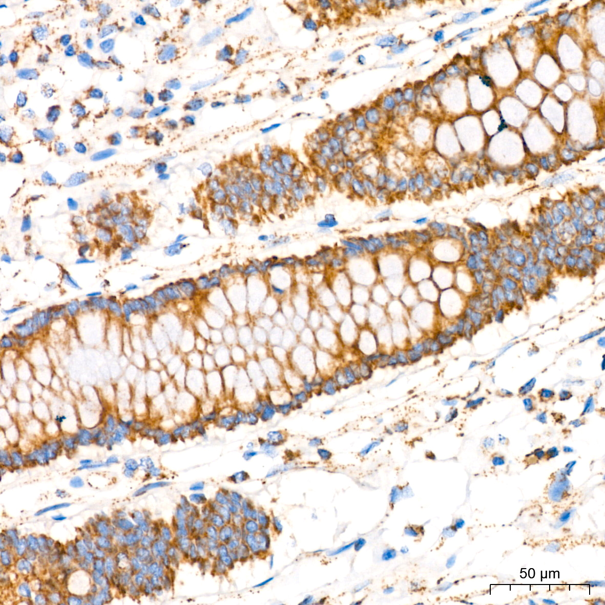 GLUD1 Rabbit mAb