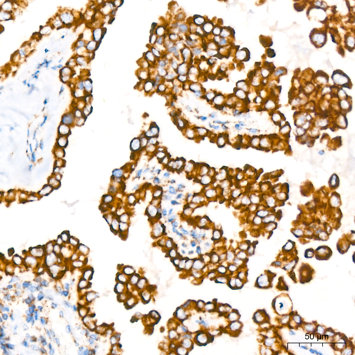 GLUD1 Rabbit mAb