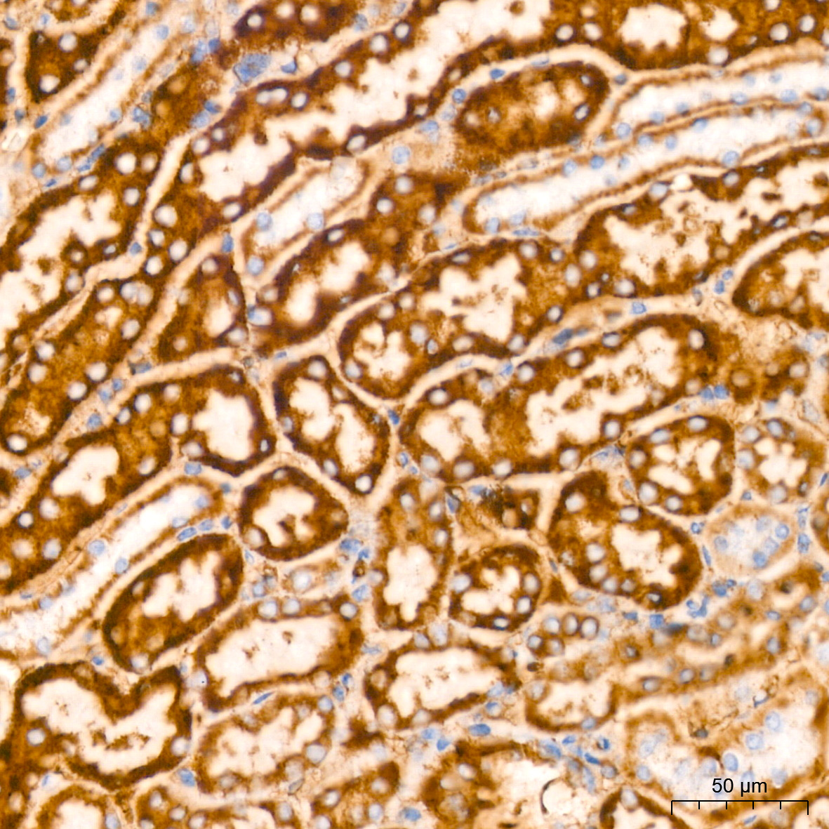 GLUD1 Rabbit mAb