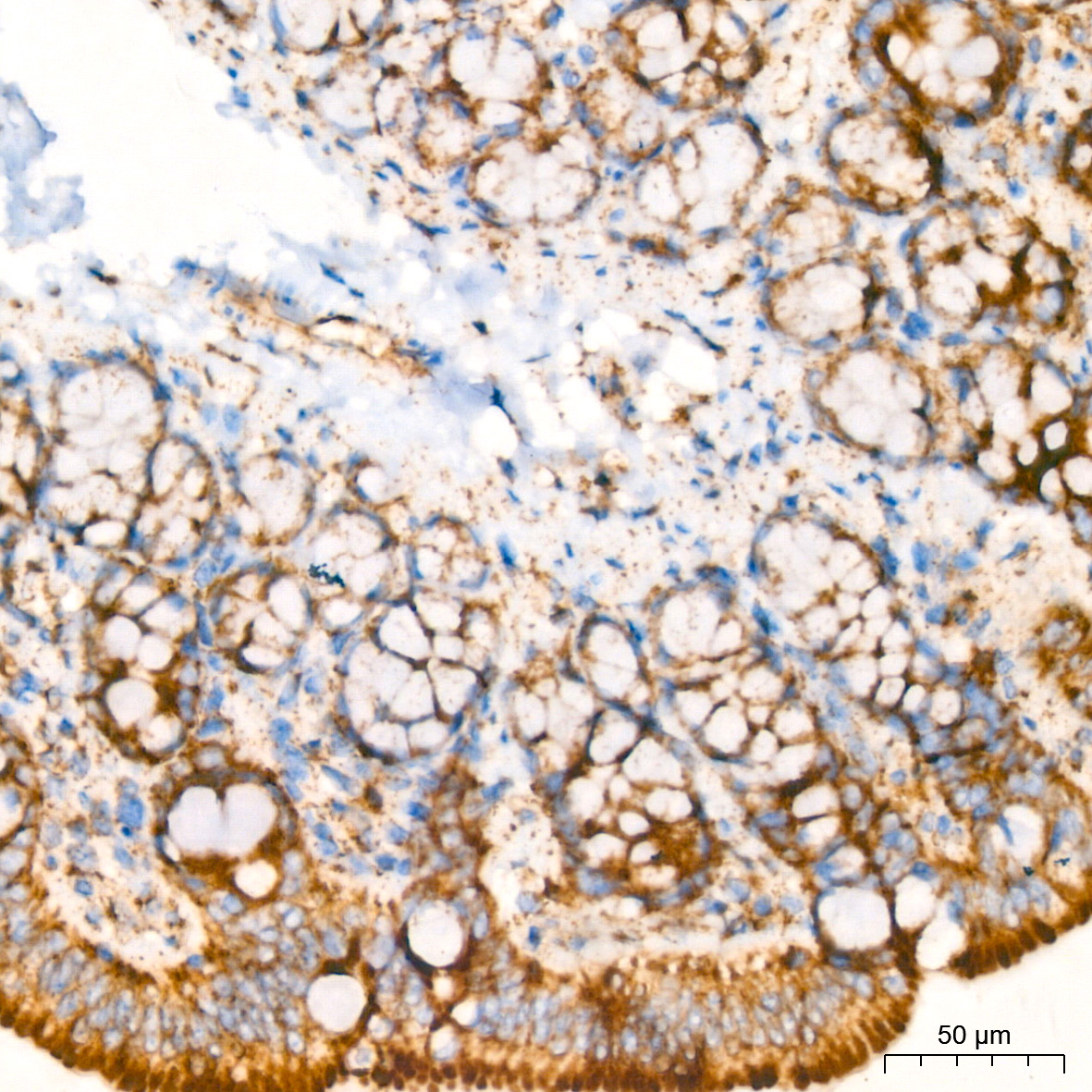 GLUD1 Rabbit mAb