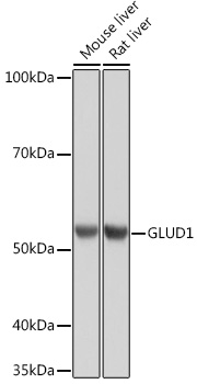 GLUD1 Rabbit mAb