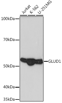 GLUD1 Rabbit mAb