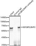 Western blot - IGF2BP2/IMP2 Rabbit mAb (A5189)