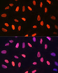 Western blot - DiMethyl-Histone H3-K14 Rabbit pAb (A5278)
