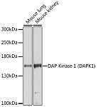 Western blot - DAP Kinase 1 (DAPK1) Rabbit pAb (A5741)