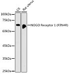 Western blot - NOGO Receptor 1 (RTN4R) Rabbit pAb (A5847)