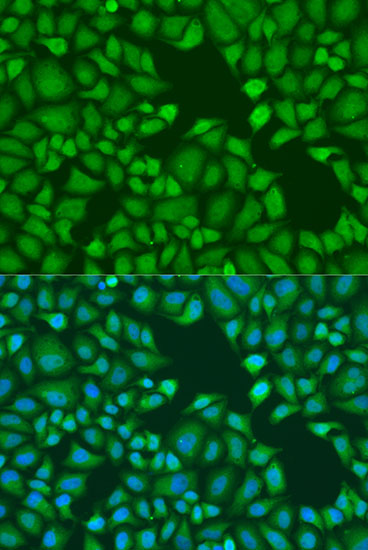 ABclonal:Immunofluorescence - TNRC6A Rabbit pAb (A6115)