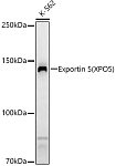 Western blot - Exportin 5 (XPO5) Rabbit pAb (A6790)