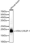 Western blot - VSNL1/VILIP-1 Rabbit pAb (A6999)