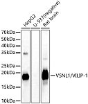Western blot - VSNL1/VILIP-1 Rabbit pAb (A6999)