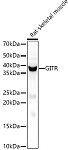 Western blot - GITR Ligand/TNFSF18 Rabbit pAb (A7028)