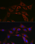 Immunofluorescence - ABCA1 Rabbit pAb (A7228)