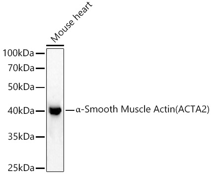 α-Smooth Muscle Actin (ACTA2) Rabbit pAb