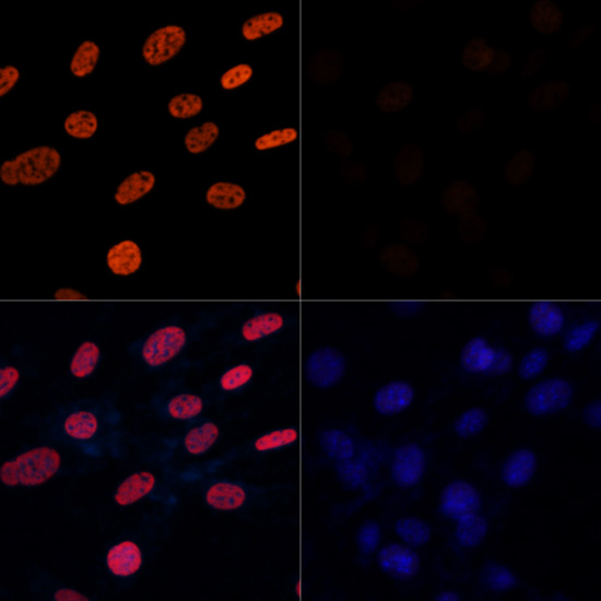 ABclonal:Immunofluorescence - Acetyl-Histone H3-K27 Rabbit pAb (A7253)}
