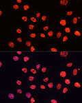 Western blot - TriMethyl-Histone H3-K56 Rabbit pAb (A7262)