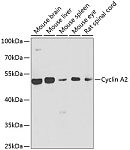 Western blot - Cyclin A2 Rabbit pAb (A7632)