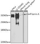 Western blot - Filamin A Rabbit pAb (A7896)