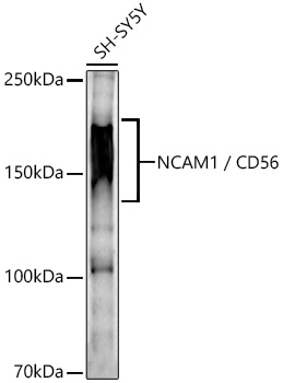 NCAM1 / CD56 Rabbit pAb